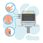 Post-procedure monitoring - one of the procedure step in TAVI/TAVR Surgery in Mumbai